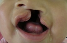 2014-03-29-mil-sonrisas-rotarios (1)